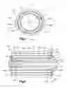 Fig. 03 - Nested expandable sleeve implant