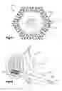 Fig. 07 - Nested expandable sleeve implant
