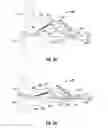 Fig. 05 - Blade deployment mechanisms for surgical forceps