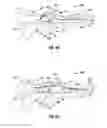 Fig. 07 - Blade deployment mechanisms for surgical forceps