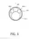 Fig. 04 - Tissue extraction devices and methods