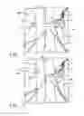 Fig. 02 - Methods for contemporaneous assessment of renal denervation
