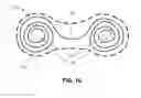 Fig. 03 - SURGICAL STERILIZATION DEVICE AND METHODS OF USE