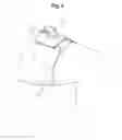 Fig. 04 - Determining the Positional Information of Characteristic Points of a Leg for Osteotomy
