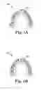 Fig. 02 - Determining a dental treatment difficulty