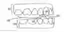 Fig. 01 - Dental appliances with repositioning jaw elements