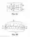 Fig. 04 - Dental appliances with repositioning jaw elements