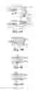 Fig. 10 - Dental appliances with repositioning jaw elements