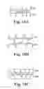 Fig. 12 - Dental appliances with repositioning jaw elements