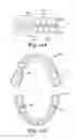 Fig. 17 - Dental appliances with repositioning jaw elements