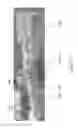 Fig. 20 - Dental appliances with repositioning jaw elements