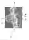 Fig. 22 - Dental appliances with repositioning jaw elements