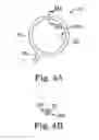 Fig. 05 - Connector cuff