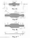 Fig. 03 - SURGICAL ARTICLES AND METHODS FOR TREATING URINARY INCONTINENCE