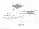 Fig. 05 - SURGICAL ARTICLES AND METHODS FOR TREATING URINARY INCONTINENCE