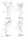 Fig. 06 - SURGICAL ARTICLES AND METHODS FOR TREATING URINARY INCONTINENCE