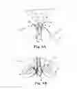 Fig. 08 - SURGICAL ARTICLES AND METHODS FOR TREATING URINARY INCONTINENCE