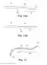 Fig. 13 - SURGICAL ARTICLES AND METHODS FOR TREATING URINARY INCONTINENCE