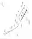Fig. 03 - Systems and methods employing a push tube for delivering a urethral sling