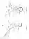 Fig. 06 - Systems and methods employing a push tube for delivering a urethral sling