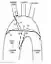Fig. 01 - INTRAVASCULAR DEVICES
