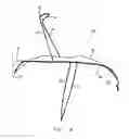 Fig. 02 - INTRAVASCULAR DEVICES