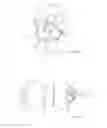 Fig. 04 - Stent graft and introducer assembly