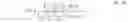Fig. 05 - METHODS AND INTRAOCULAR LENS FOR COUNTERACTING ASTIGMATISM ABERRATIONS