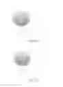 Fig. 09 - METHODS AND INTRAOCULAR LENS FOR COUNTERACTING ASTIGMATISM ABERRATIONS