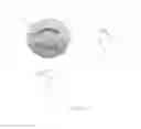 Fig. 13 - METHODS AND INTRAOCULAR LENS FOR COUNTERACTING ASTIGMATISM ABERRATIONS