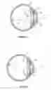 Fig. 04 - Intraocular lens systems and methods