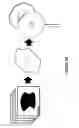 Fig. 30 - Methods and Materials for an Artificial Voice Prosthesis