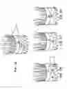 Fig. 07 - Means for Controlled Sealing of Endovascular Devices