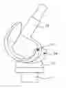 Fig. 01 - Prosthesis Component With Antimicrobially Coating Sliding Surface
