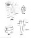Fig. 03 - Anatomic osteotomy wedge