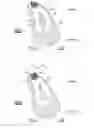 Fig. 04 - Anatomic osteotomy wedge