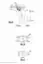 Fig. 05 - Anatomic osteotomy wedge