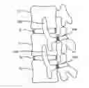 Fig. 01 - Flexible anchoring and fusion devices and methods of using the same