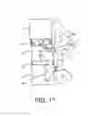 Fig. 13 - Flexible anchoring and fusion devices and methods of using the same
