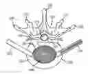 Fig. 01 - Coiling implantable prostheses