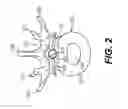 Fig. 03 - Coiling implantable prostheses
