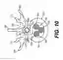 Fig. 12 - Coiling implantable prostheses