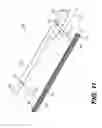 Fig. 13 - Coiling implantable prostheses
