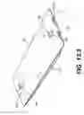Fig. 18 - Coiling implantable prostheses