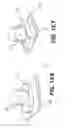 Fig. 19 - Coiling implantable prostheses