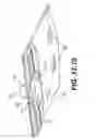 Fig. 22 - Coiling implantable prostheses