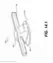Fig. 26 - Coiling implantable prostheses