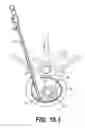 Fig. 31 - Coiling implantable prostheses