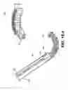 Fig. 53 - Coiling implantable prostheses