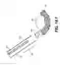 Fig. 56 - Coiling implantable prostheses
